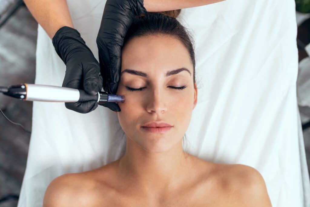a photo of a woman getting microneedling treatment